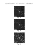 USE OF AN ANTI-TAU PS422 ANTIBODY FOR THE TREATMENT OF BRAIN DISEASES diagram and image