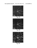 USE OF AN ANTI-TAU PS422 ANTIBODY FOR THE TREATMENT OF BRAIN DISEASES diagram and image