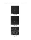 USE OF AN ANTI-TAU PS422 ANTIBODY FOR THE TREATMENT OF BRAIN DISEASES diagram and image