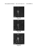 USE OF AN ANTI-TAU PS422 ANTIBODY FOR THE TREATMENT OF BRAIN DISEASES diagram and image