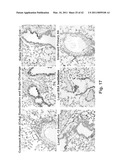 C/CLP Antagonists And Methods Of Use Thereof diagram and image