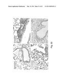 C/CLP Antagonists And Methods Of Use Thereof diagram and image