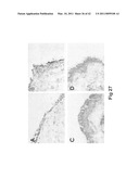 C/CLP Antagonists And Methods Of Use Thereof diagram and image