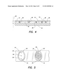 METHOD AND APPARATUS FOR DETERMINING RED BLOOD CELL INDICES OF A BLOOD SAMPLE UTILIZING THE INTRINSIC PIGMENTATION OF HEMOGLOBIN CONTAINED WITHIN THE RED BLOOD CELLS diagram and image