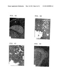 EXPRESSION VECTORS AND CELL LINES EXPRESSING VASCULAR ENDOTHELIAL GROWTH FACTOR D, AND METHOD OF TREATING MELANOMAS diagram and image