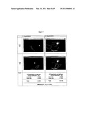 METHOD OF REVERSING, PREVENTING, DELAYING OR STABILIZING SOFT TISSUE CALCIFICATION diagram and image