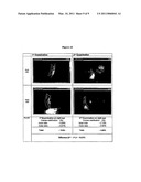 METHOD OF REVERSING, PREVENTING, DELAYING OR STABILIZING SOFT TISSUE CALCIFICATION diagram and image