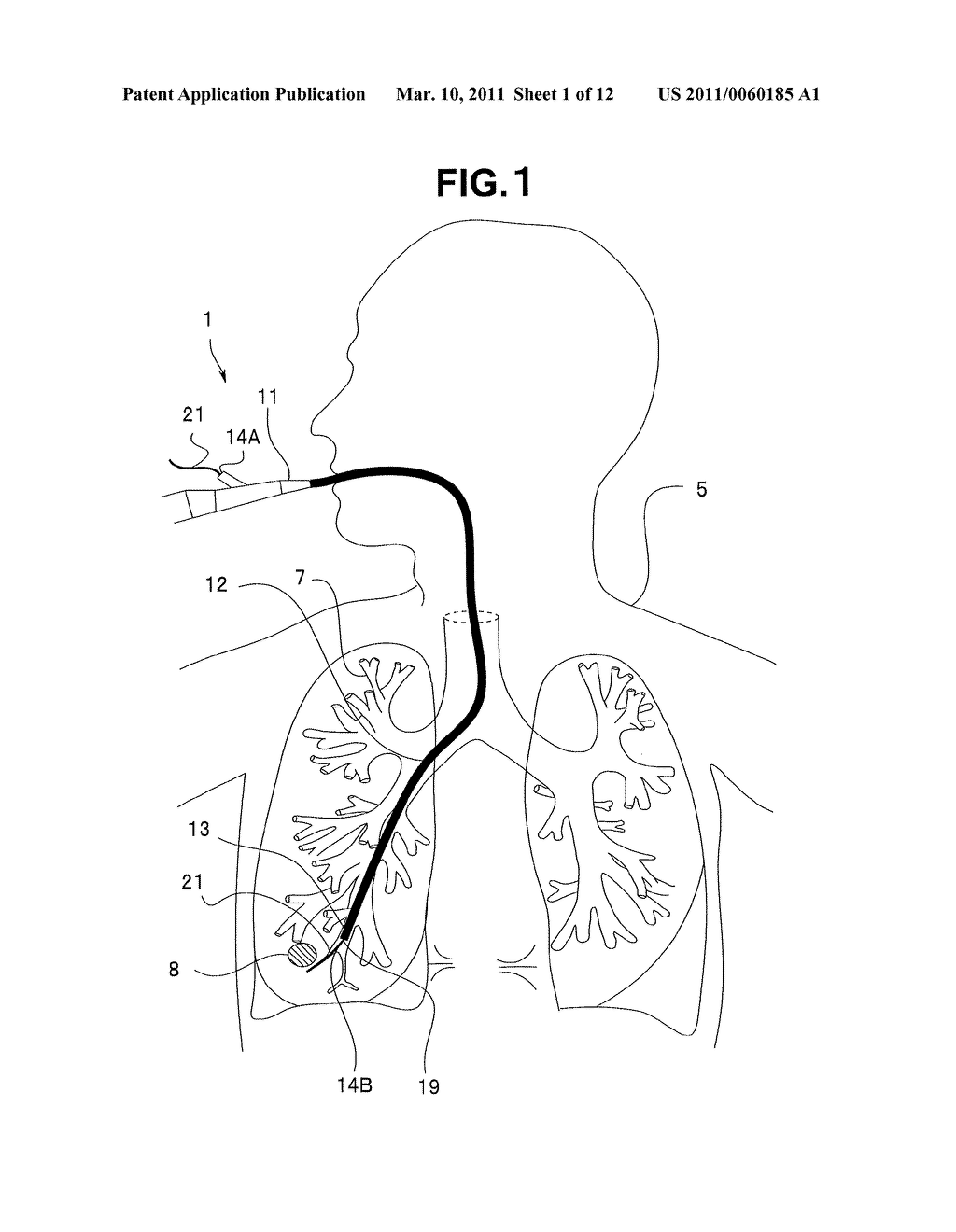 MEDICAL DEVICE SYSTEM AND CALIBRATION METHOD FOR MEDICAL INSTRUMENT - diagram, schematic, and image 02