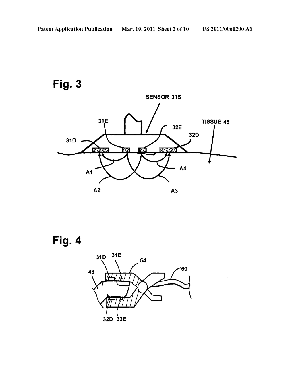 IN VIVO BLOOD SPECTROMETRY - diagram, schematic, and image 03