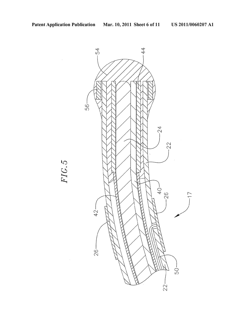 CATHETER WITH CONTRACTABLE MAPPING ASSEMBLY - diagram, schematic, and image 07