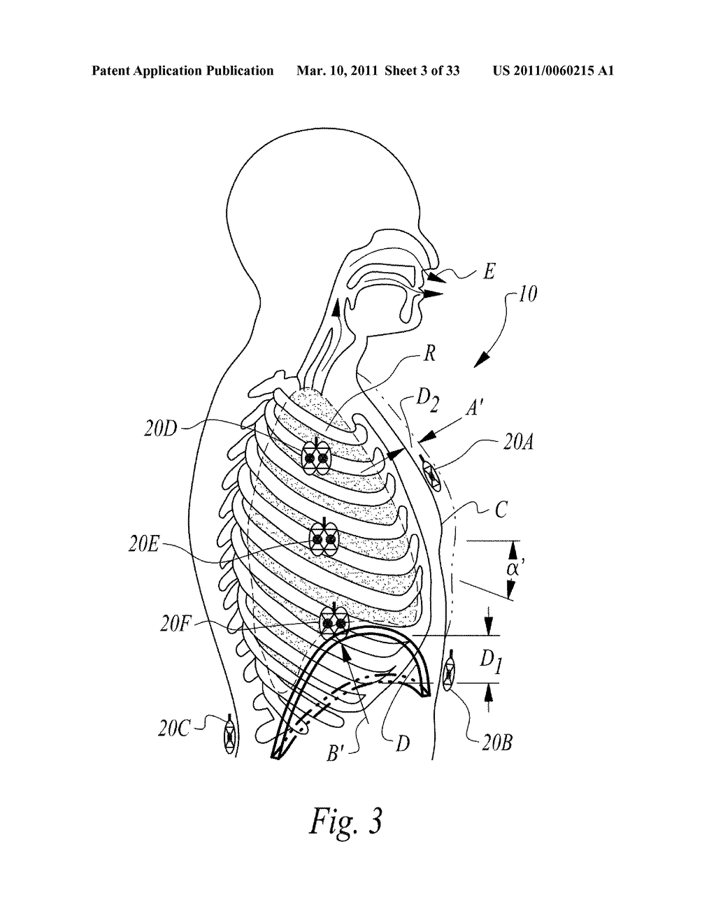 APPARATUS AND METHOD FOR CONTINUOUS NONINVASIVE MEASUREMENT OF RESPIRATORY FUNCTION AND EVENTS - diagram, schematic, and image 04