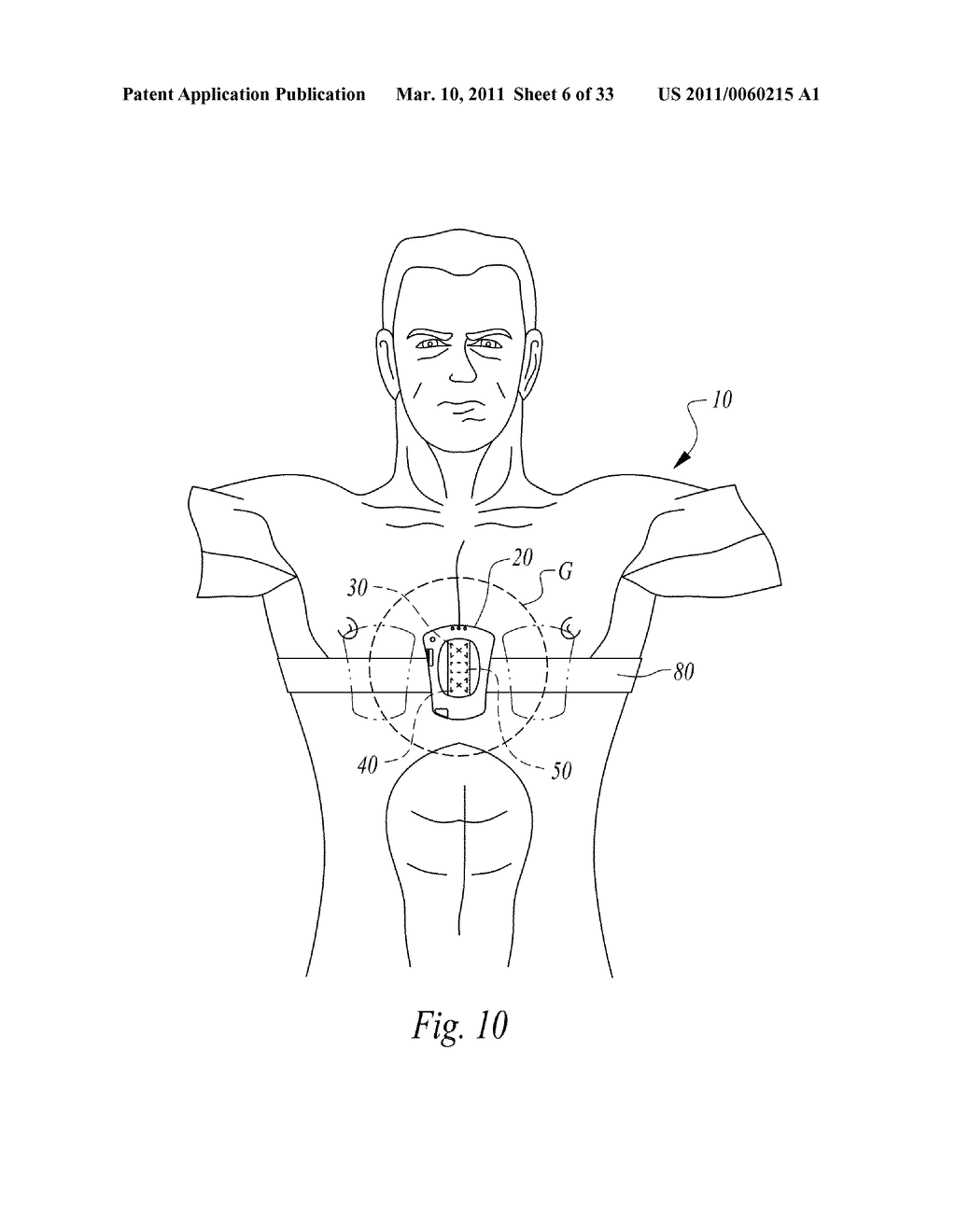 APPARATUS AND METHOD FOR CONTINUOUS NONINVASIVE MEASUREMENT OF RESPIRATORY FUNCTION AND EVENTS - diagram, schematic, and image 07