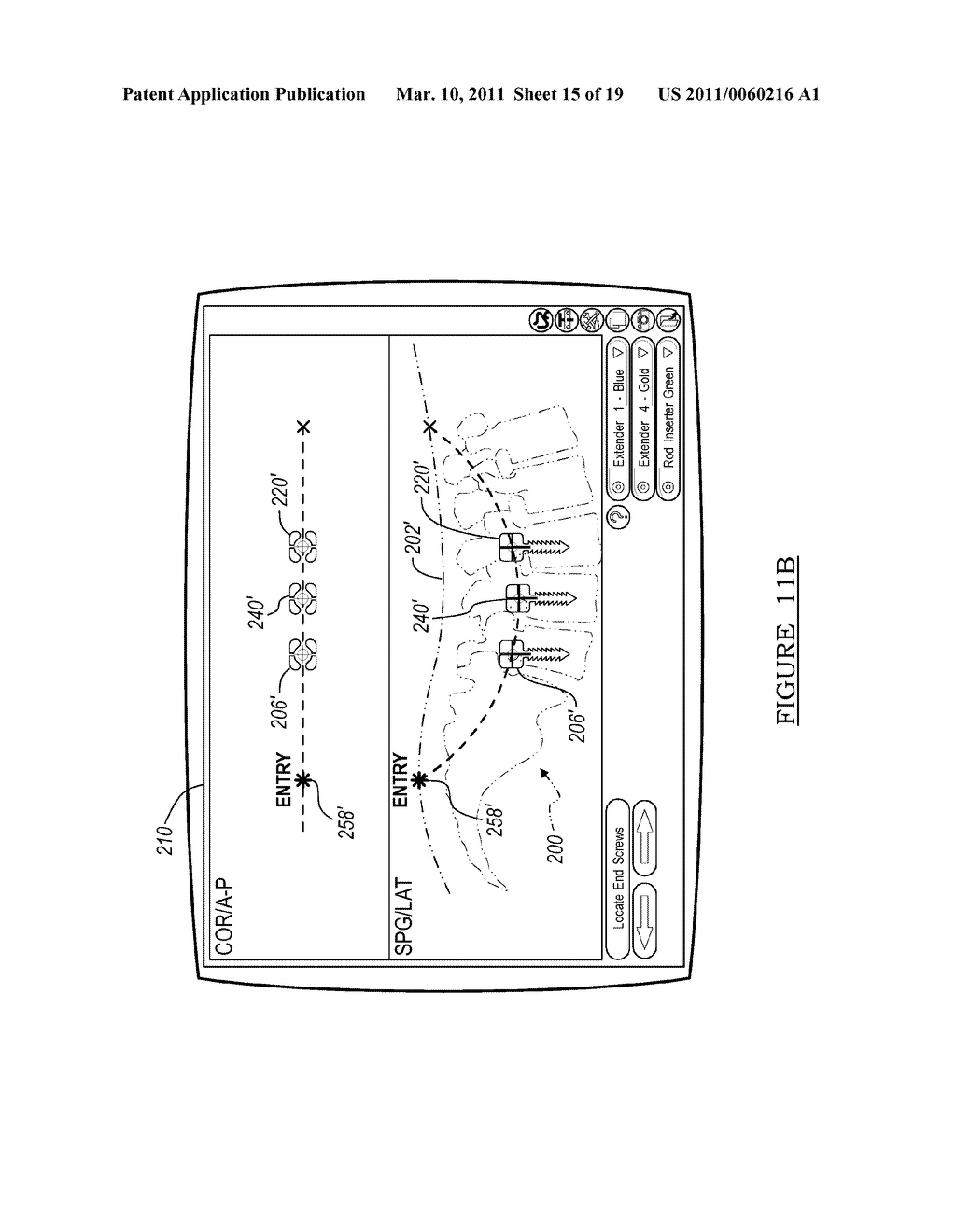Method and Apparatus for Surgical Navigation of a Multiple Piece Construct for Implantation - diagram, schematic, and image 16