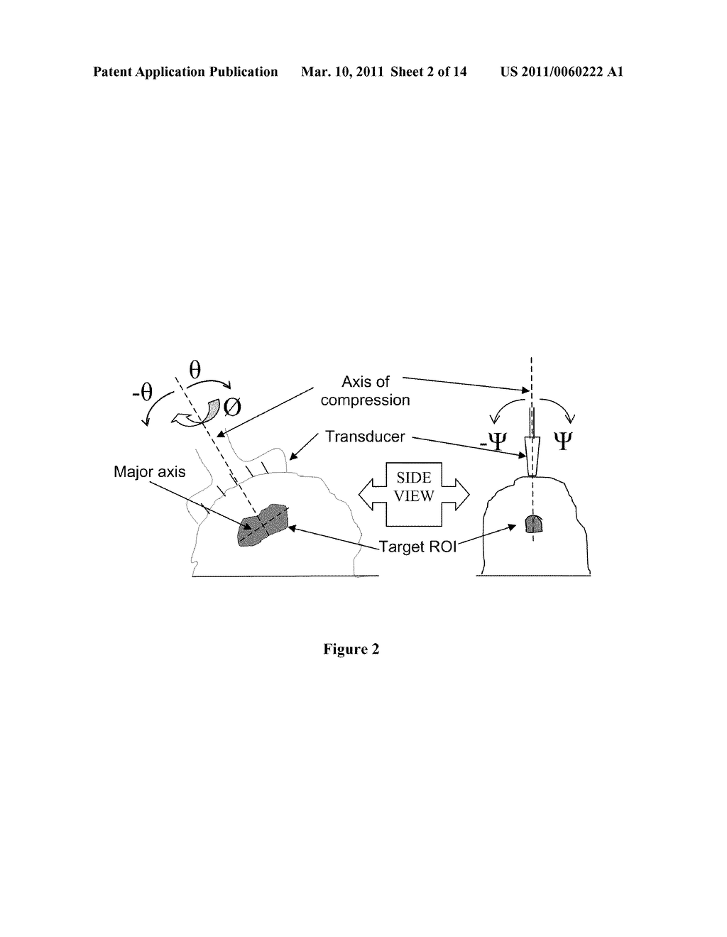 METHOD AND APPARATUS FOR CHARACTERIZING INHOMGENEITIES USING AXIAL SHEAR STRAIN ELASTOGRAPHY - diagram, schematic, and image 03