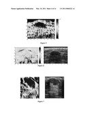 METHOD AND APPARATUS FOR CHARACTERIZING INHOMGENEITIES USING AXIAL SHEAR STRAIN ELASTOGRAPHY diagram and image