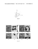 METHOD AND APPARATUS FOR CHARACTERIZING INHOMGENEITIES USING AXIAL SHEAR STRAIN ELASTOGRAPHY diagram and image