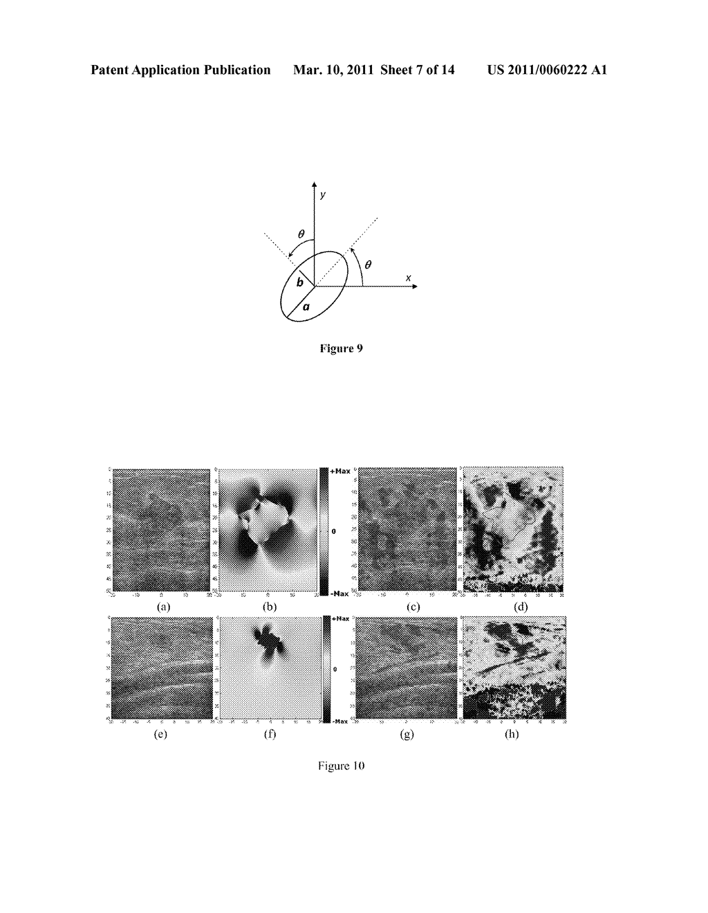 METHOD AND APPARATUS FOR CHARACTERIZING INHOMGENEITIES USING AXIAL SHEAR STRAIN ELASTOGRAPHY - diagram, schematic, and image 08