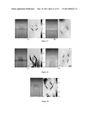 METHOD AND APPARATUS FOR CHARACTERIZING INHOMGENEITIES USING AXIAL SHEAR STRAIN ELASTOGRAPHY diagram and image