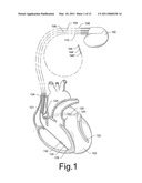 DETERMINATION OF DIASTOLIC HEART FAILURE diagram and image