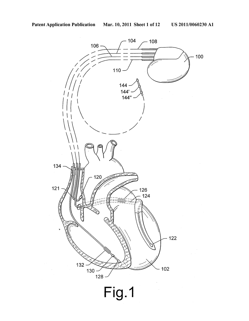 DETERMINATION OF DIASTOLIC HEART FAILURE - diagram, schematic, and image 02