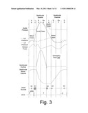 DETERMINATION OF DIASTOLIC HEART FAILURE diagram and image