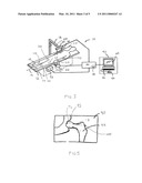 METHODS AND APPARATUS FOR MEASURING BONE LENGTHS diagram and image