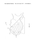 ENHANCED STEM CELL THERAPY AND STEM CELL PRODUCTION THROUGH THE ADMINISTRATION OF LOW LEVEL LIGHT ENERGY diagram and image