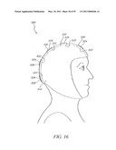 ENHANCED STEM CELL THERAPY AND STEM CELL PRODUCTION THROUGH THE ADMINISTRATION OF LOW LEVEL LIGHT ENERGY diagram and image