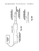 Microporation of Tissue for Delivery Of Bioactive Agents diagram and image