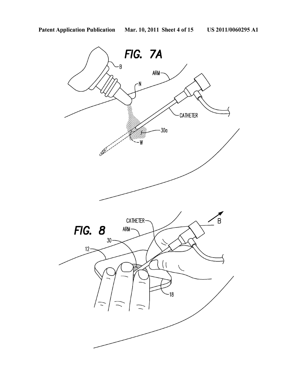 Method of Reducing Infections and/or Air Embolisms Associated with Vascular Access Procedures - diagram, schematic, and image 05