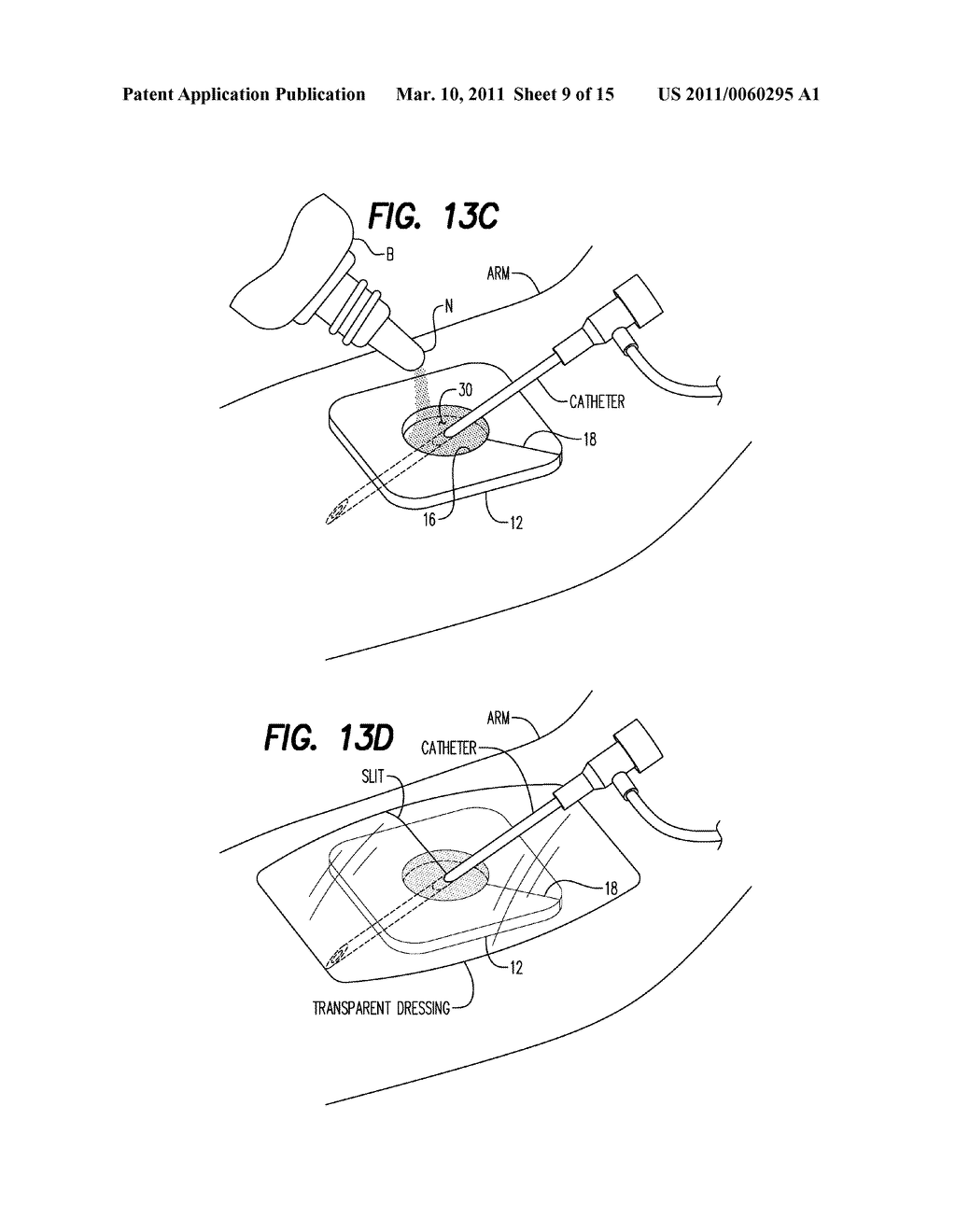 Method of Reducing Infections and/or Air Embolisms Associated with Vascular Access Procedures - diagram, schematic, and image 10