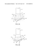 TISSUE IMAGING AND EXTRACTION SYSTEMS diagram and image