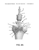 IMPLANTS WITH TRANSITION SURFACES AND RELATED PROCESSES diagram and image