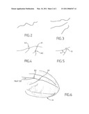 Device and Method for Superimposing Patterns on Images in Real-Time, Particularly for Guiding by Localisation diagram and image