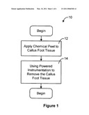 CALLUS-TISSUE-DEBRIDEMENT APPARATUS AND METHOD diagram and image