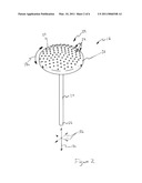 CALLUS-TISSUE-DEBRIDEMENT APPARATUS AND METHOD diagram and image