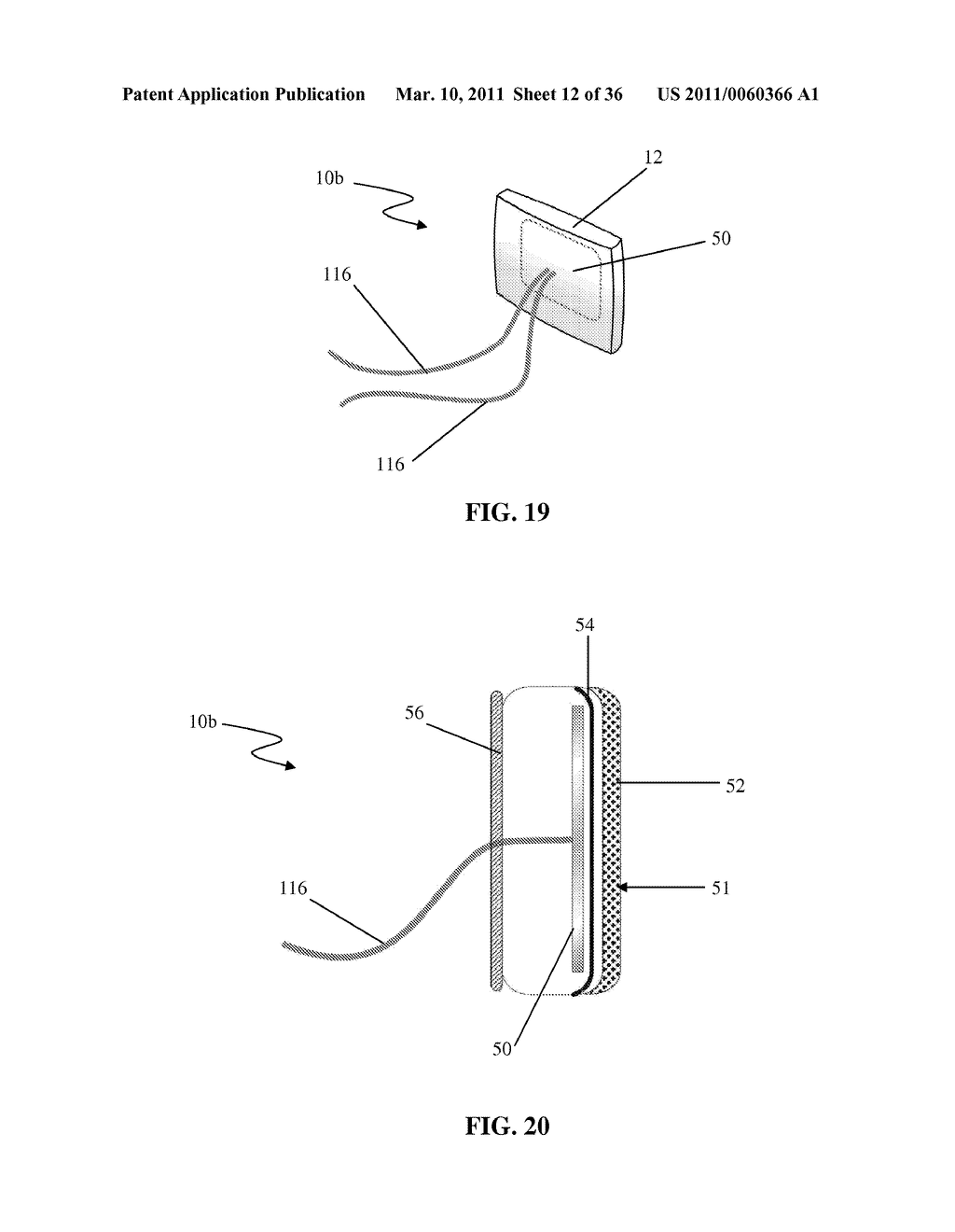 Facet Joint Implant and Related Methods - diagram, schematic, and image 13