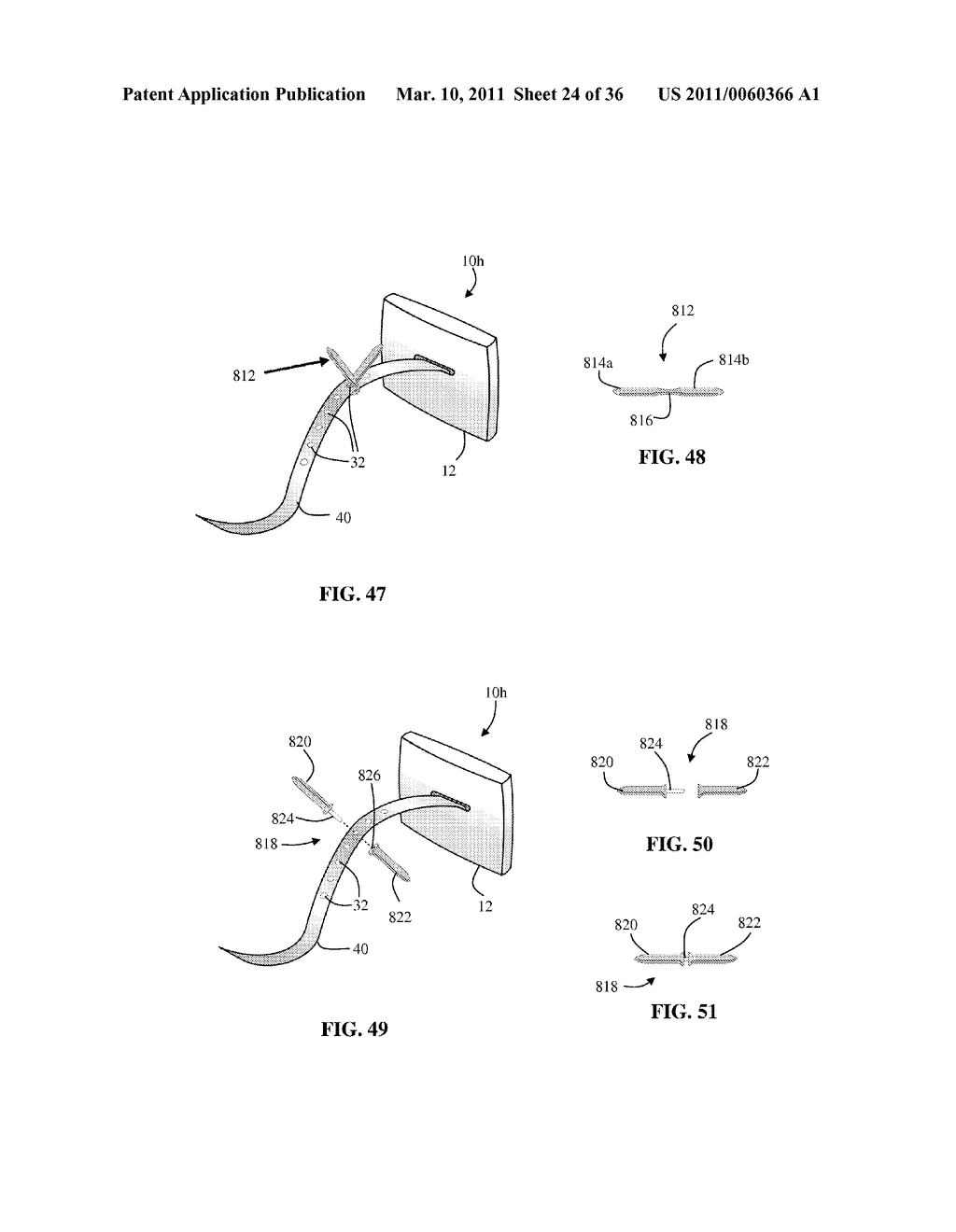 Facet Joint Implant and Related Methods - diagram, schematic, and image 25