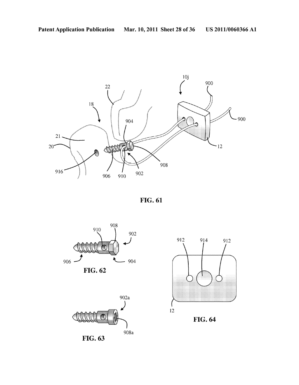 Facet Joint Implant and Related Methods - diagram, schematic, and image 29