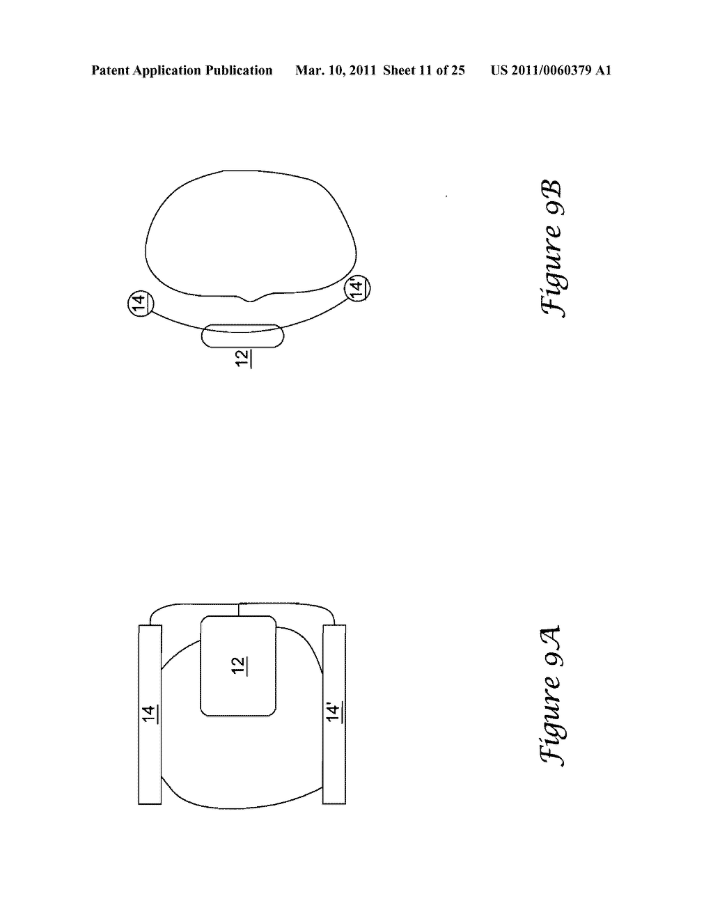 Anterior Active Housing Subcutaneous Positioning Methods - diagram, schematic, and image 12