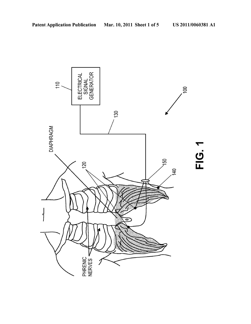 System and Method for Conditioning a Diaphragm of a Patient - diagram, schematic, and image 02