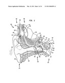 DETERMINING STIMULATION LEVEL PARAMETERS IN IMPLANT FITTING diagram and image