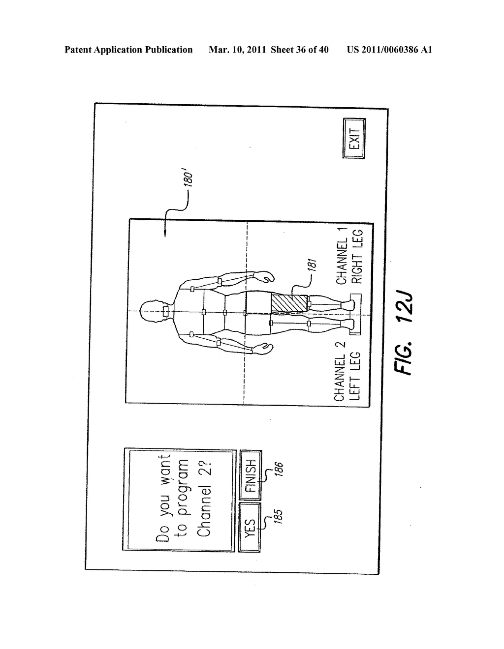 SYSTEM AND METHOD FOR DISPLAYING STIMULATION FIELD GENERATED BY ELECTRODE ARRAY - diagram, schematic, and image 37