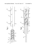 METHOD OF LOADING A STENT INTO A SHEATH diagram and image