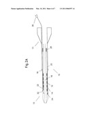 METHOD OF LOADING A STENT INTO A SHEATH diagram and image