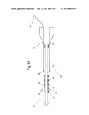 METHOD OF LOADING A STENT INTO A SHEATH diagram and image