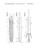 METHOD OF LOADING A STENT INTO A SHEATH diagram and image