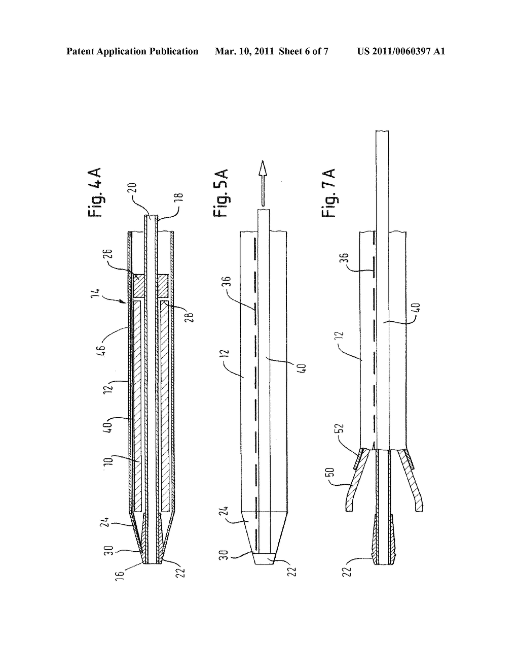 METHOD OF LOADING A STENT INTO A SHEATH - diagram, schematic, and image 07