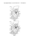 METHODS, SYSTEMS AND DEVICES FOR CARDIAC VALVE REPAIR diagram and image