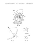 METHODS, SYSTEMS AND DEVICES FOR CARDIAC VALVE REPAIR diagram and image